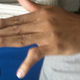 Illustration for article titled Look At Shawn Marions Disgustingly Dislocated Pinkie